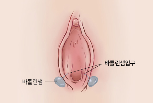 바톨린샘 / 바톨린샘입구
