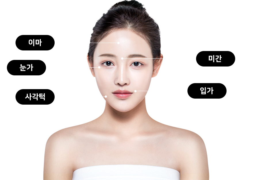 이마, 미간, 눈가, 사각턱, 입가